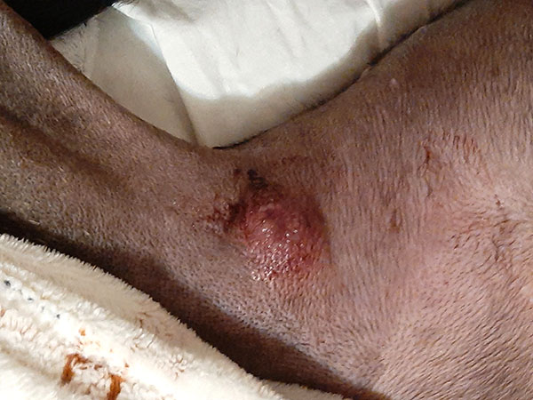 Pre Injection - Mast Cell Tumor on Limb