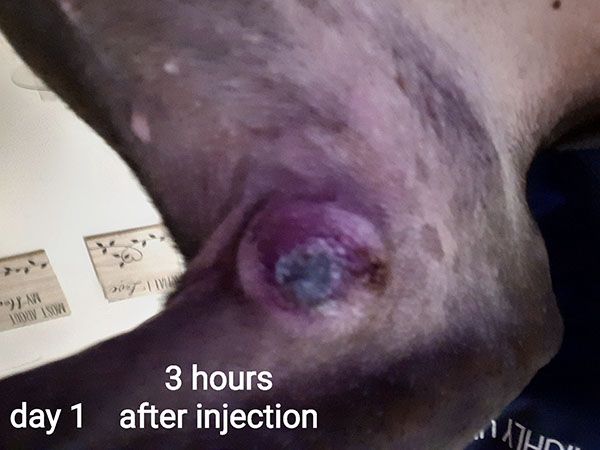3 hours after injection - MCT injected with STELFONTA