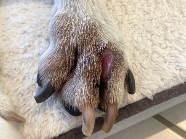 STELFONTA treatment - Day 18